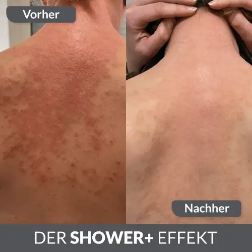 Starterset Salzdusche mit Base+ und 14 PURE Salz Sticks aus naturreinem Meersalz - Made in Germany von shower+